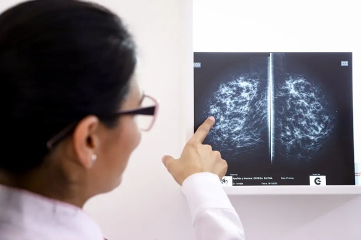 Steps to take to reduce the risk of breast cancer