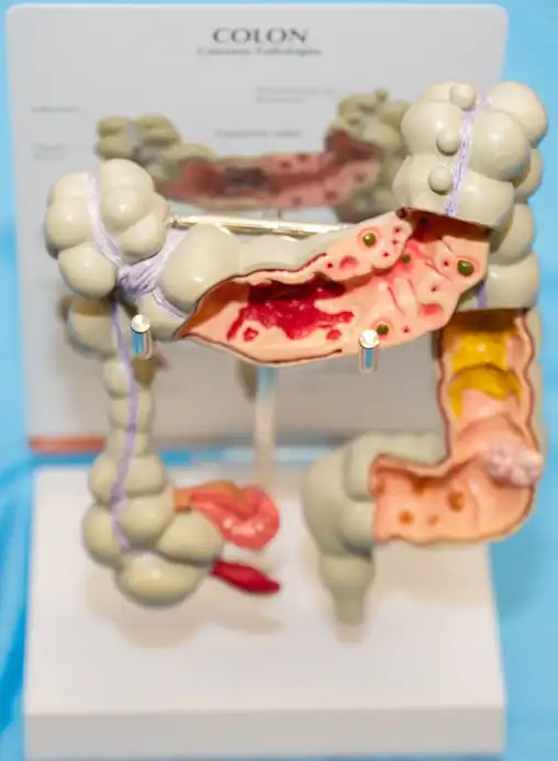 They promote the prevention, detection and treatment of colorectal cancer in NYC and Long Island